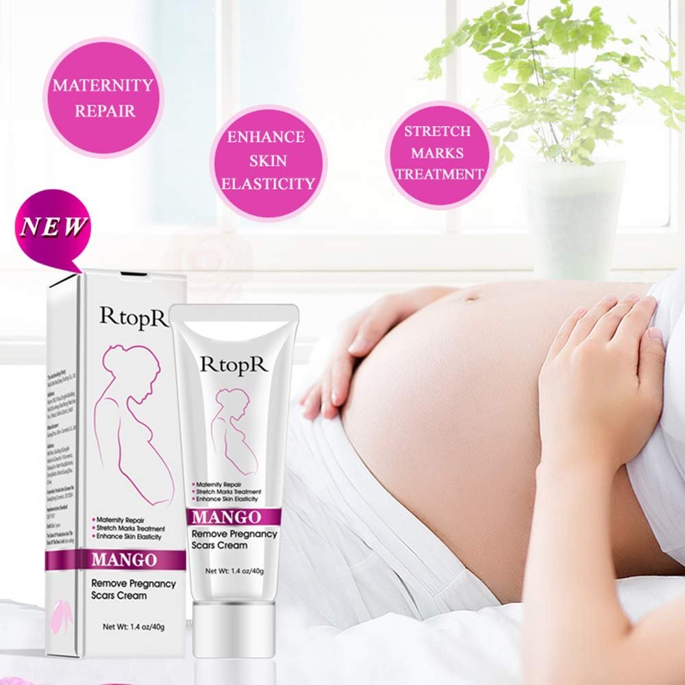 Mango Stretch Marks and Scar Cream, Stretch Marks and Scar Removal Cream for Pregnancy, Stretch Marks Scar Belly Creams for Wrinkles, Obesity Fat Stretch Mark Moisturizing, Remove Marks (40g)