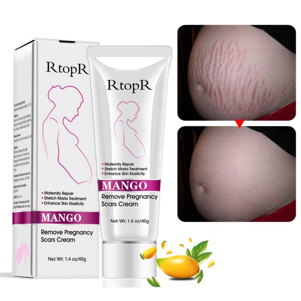 Mango Stretch Marks and Scar Cream, Stretch Marks and Scar Removal Cream for Pregnancy, Stretch Marks Scar Belly Creams for Wrinkles, Obesity Fat Stretch Mark Moisturizing, Remove Marks (40g) Mango Stretch Marks and Scar Cream, Stretch Marks and Scar Removal Cream for Pregnancy, Stretch Marks Scar Belly Creams for Wrinkles, Obesity Fat Stretch Mark Moisturizing, Remove Marks (40g)